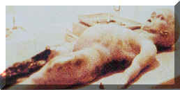 Szenenaufnahme des sezierten Aliens aus dem angeblich authentischen Santillifilm, welcher inzwischen offiziell als Flschung gilt